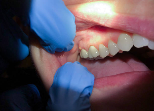 Best Cracked Tooth Emergency Dentist  in Crainvle, IL